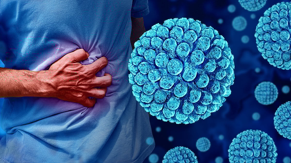 대장균 이미지 대장균 이미지